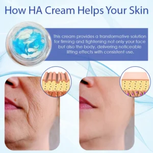 HZA™ Deep Elastic SkinRenew HA Cream