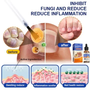 KUBOZN™ Bee Venom Nail Fungus Treatment Solution