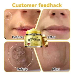 Lotmay™ Bee Venom Skin Treatment Cream